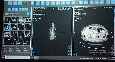 Van'dan dünyaya örnek çalışma: Kanser tedavisinde yapay zekâ kullanıldı