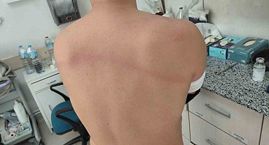 CHP'li dayakçı başkan hakkında 'Silahla kasten yaralamadan' iddianame hazırlandı