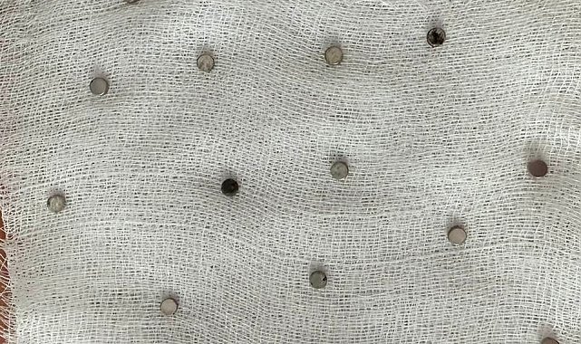 Çocuğun boğazından 19 adet mıknatıs çıkartıldı