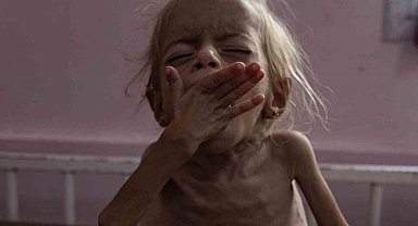 Gazze'de 2 kişi daha açlıktan hayatını kaybetti