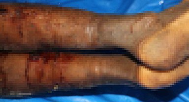 İsrail'in iade ettiği cenazelerde işkence izleri görüldü