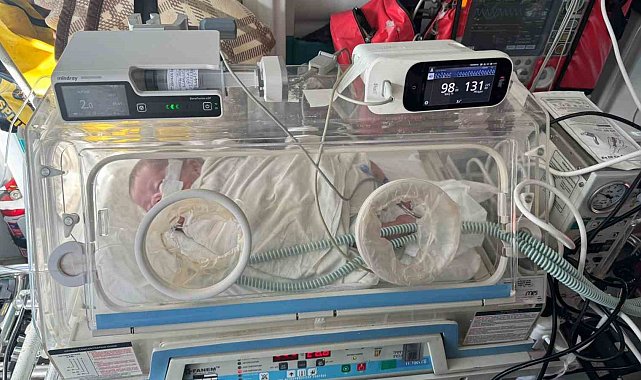 Kerem bebek, hava yolu ile Karabük'e sevk edilerek tedavi altına alındı