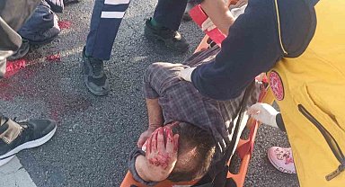 Köpeğe çarpmamak için manevra yapınca bariyerlere çarpıp yaralandı