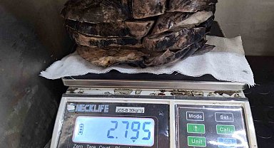 Nefes darlığı şikayeti ile hastaneye gitti, göğsünden 3 kilogramlık tümör çıktı