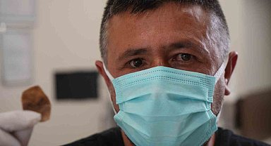 Protez gözü hayatını kabusa çevirdi