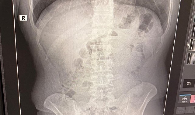 Uşak'ta midelerinden uyuşturucu çıktı: İranlı 3 kişi tutuklandı