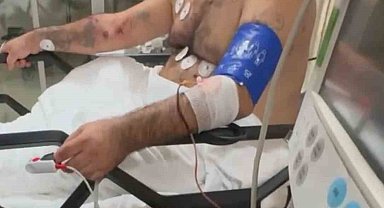 Bayrampaşa'da pompalı tüfekle çevreye ateş eden şahıs, 1'i polis 4 kişiyi yaraladı