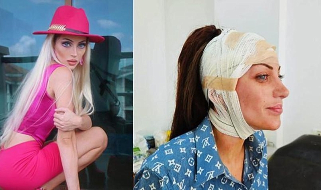 Genç kızlar dikkat! Barbie olmak uğruna yaşamını yitirdi