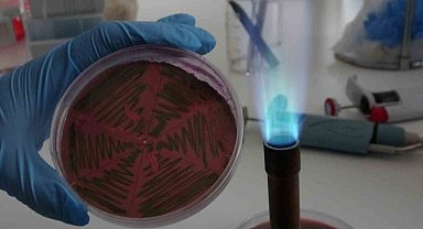 Çiğ süt, gıdayla bulaşan idrar yolu enfeksiyonlarına kapı açıyor