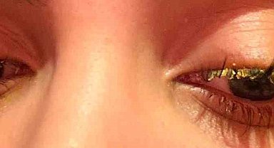 Güzellik merkezinde genç kadının gözüne yapıştırıcı kaçtı: "Kör olabilirdim"