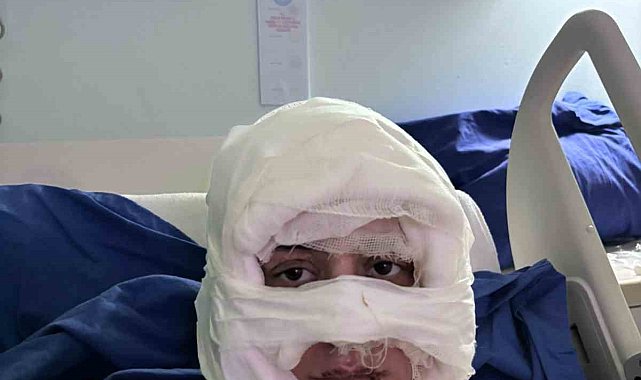 Kadıköy'de akıl almaz olay: Genç kadın başka bir kadın tarafından ateşe verildi