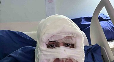 Kadıköy'de akıl almaz olay: Genç kadın başka bir kadın tarafından ateşe verildi