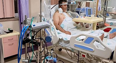 Kalp ameliyatında ECMO başarısı, bir ilk oldu