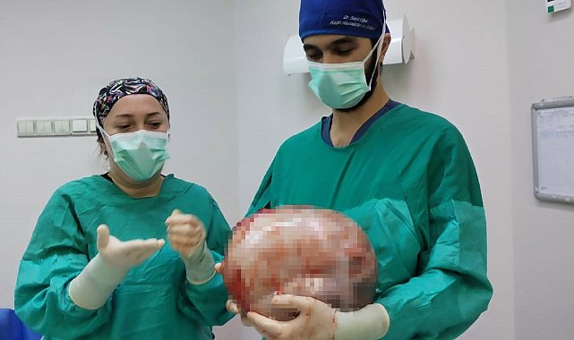 Karnı 2 ayda 9 aylık hamile gibi büyüyen kadının içinden karpuz kadar kitle çıkarıldı