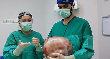 Karnı 2 ayda 9 aylık hamile gibi büyüyen kadının içinden karpuz kadar kitle çıkarıldı