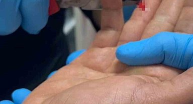 Balık macerası hastanede bitti: Parmağına saplanan olta iğnesini itfaiye çıkarttı