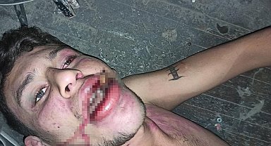 Hamam böceği yedirilen gencin dosyasında karar: Yağmadan beraat, hürriyeti tehditten 6 yıl 12 ay ceza