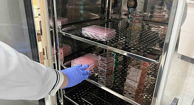 Parkinson'da bağırsak- beyin iletişimi çip üstü organ teknolojisiyle araştırılıyor