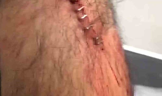Şanlıurfa'da görev yapan öğretmene sokak ortasında jiletli saldırı