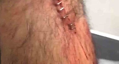 Şanlıurfa'da görev yapan öğretmene sokak ortasında jiletli saldırı