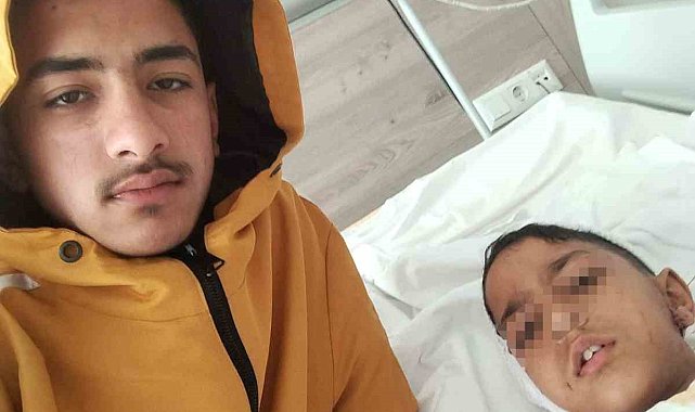 Ankara'da sokak köpeğinin saldırısına uğrayan çocuk yaralandı