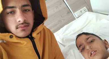 Ankara'da sokak köpeğinin saldırısına uğrayan çocuk yaralandı