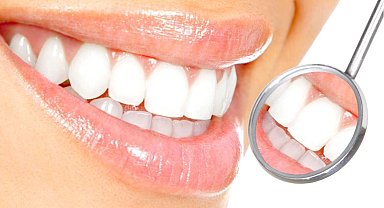 Diş beyazlatmada doğru bilinen yanlışlar!