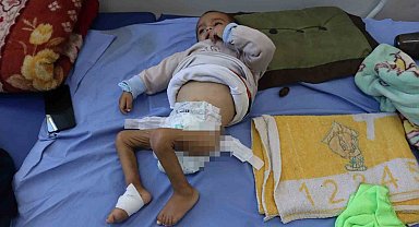 Gazzeli çocuklar ateşkesin gölgesinde açlıkla savaşıyor