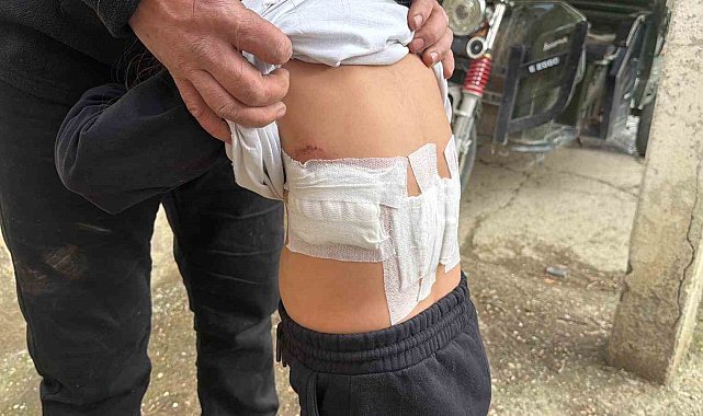 Saldırgan eşek evinin önünde oynayan 5 yaşındaki çocuğa kabusu yaşattı