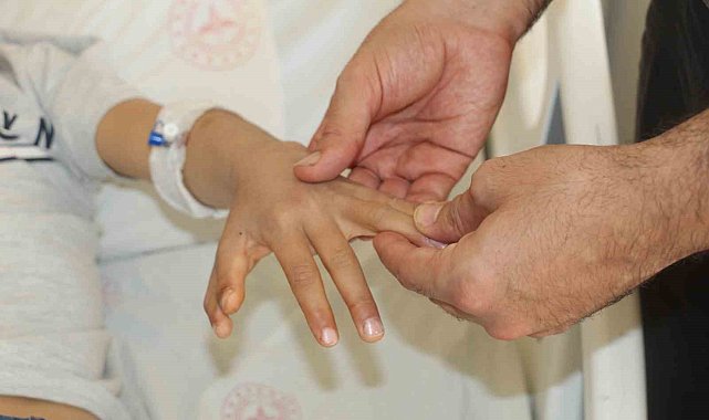 Şırnak'ta yapışık parmaklı iki kardeş ameliyatla sağlıklarına kavuştu