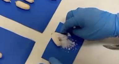 Türkiye'ye midesinde uyuşturucu sokan şahıslara operasyon