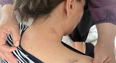 17 bıçak darbesi aldı, ölü numarasıyla kurtuldu, kocasının en ağır cezayı almasını istedi