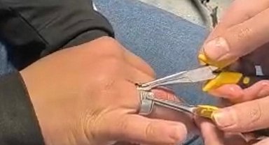 Batman'da parmağa sıkışan yüzük itfaiye ekiplerince çıkarıldı