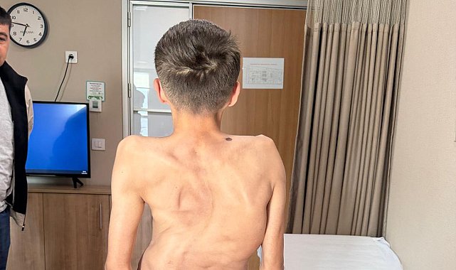 Kırgızistanlı genç şifayı Türk hekimlerinde buldu