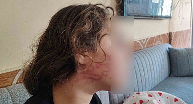 8 yaşındaki kızını darp eden çocuğun epilepsi hastası ablasını sokak ortasında dövdüğü iddiası