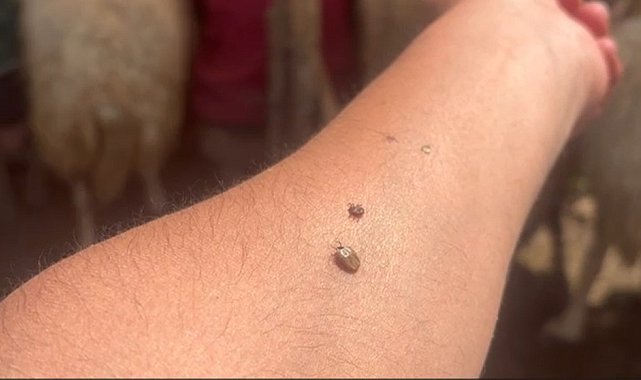 Kene popülasyonu arttı, uzmanlar tedbir çağrısı yaptı