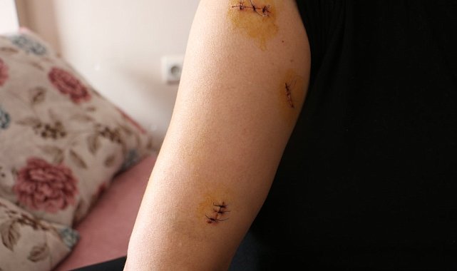 Kocası tarafından 30 yerinden bıçaklandı, görümcesi şikayetini geri çekmesini istedi