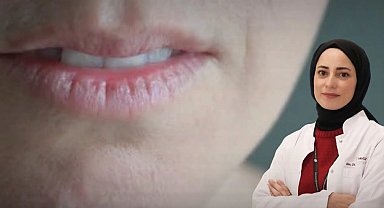 Ağız kuruluğu uyarısı! Sürekli su içme ihtiyacı başka hastalıkların habercisi olabilir
