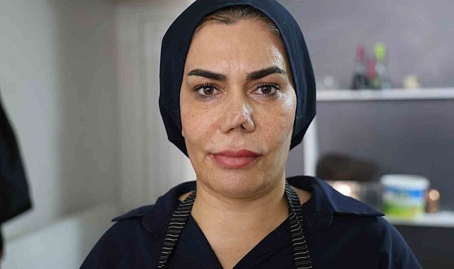 Bakım merkezinde burnu kırıldı, iyileşmek için geçirdiği 4 operasyon sonrası hayatı kabusa döndü