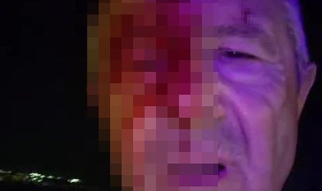 Haber yaparken saldırıya uğrayan muhabir yaralandı