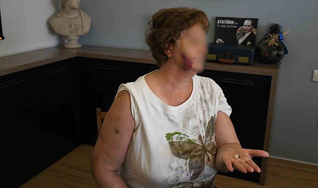 Kuşadası'nda ev kavgası kanlı bitti: Anne ve iki çocuğu bıçaklandı