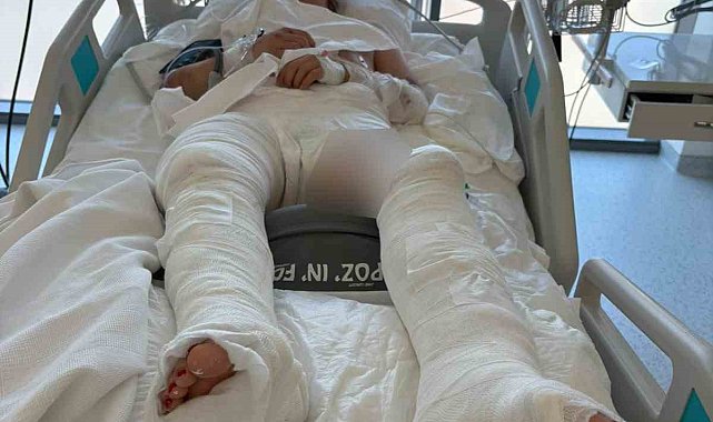 Otomobilin çarptıktan sonra üzerinden geçtiği genç kız ağır yaralandı