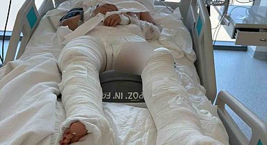 Otomobilin çarptıktan sonra üzerinden geçtiği genç kız ağır yaralandı