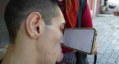 Engelleri burnuyla aştı: Telefonuyla hayata tutundu