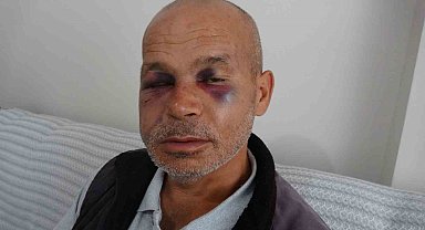 Engelli adamı darbeden şüpheli serbest bırakıldı