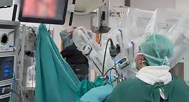 Karadeniz'de ilk: Robot yardımlı akciğer kanseri ameliyatı gerçekleştirildi