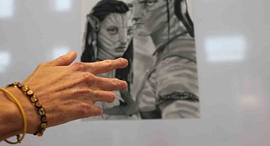 Dünyada sadece 22 kişide görülen hastalıkla mücadele eden Yunus Can'ın azmi sanata dönüştü