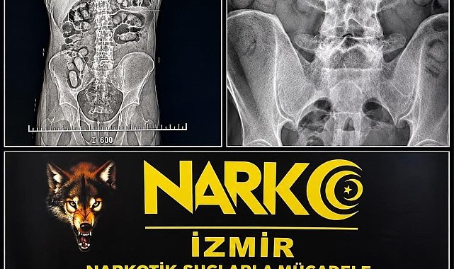 Havalimanında şüpheli yolcuların midesinden uyuşturucu çıktı