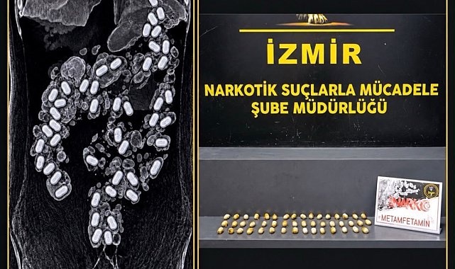 Havalimanında yakalandı: Midesinden 47 kapsül uyuşturucu çıktı