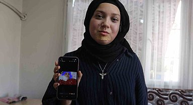 Kanseri yenen Buse'nin hayali kendisi gibi hastalara umut olmak